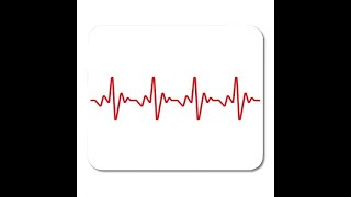 Electrocardiogram screenshot 1