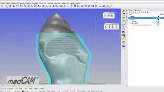 DriveSurfaceReshape
