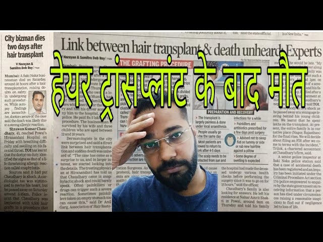 Reason to Avoiding a Cheap Hair Transplant Treatment  DHI India