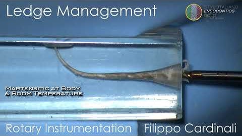 Cardinali - ledge management 3