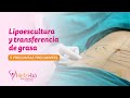 Lipoescultura y transferencia de grasa