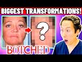 Plastic Surgeon Reacts to BOTCHED: The Most AMAZING Transformations!