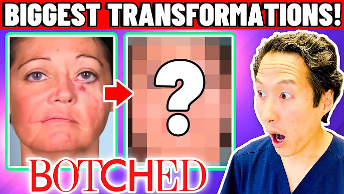 Plastic Surgeon Reacts to BOTCHED! 