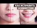 Асимметрия лица - причины возникновения. Как исправить асимметрию лица