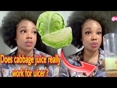 DOES CABBAGE JUICE REALLY WORK FOR ULCER |HEAL STOMACH ULCER AT HOME| how to prepare cabbage🥬 juice