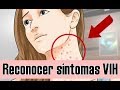 Cómo reconocer los síntomas del VIH