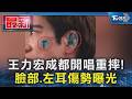 王力宏成都開唱重摔! 臉部.左耳傷勢曝光｜TVBS新聞 @TVBSNEWS01