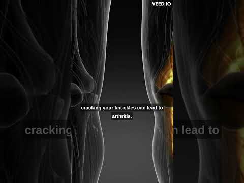 Video: Krakovanie kĺbov nespôsobuje artritídu