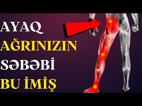 Video: Boş ayaqqabılar ayaq ağrısına səbəb ola bilərmi?