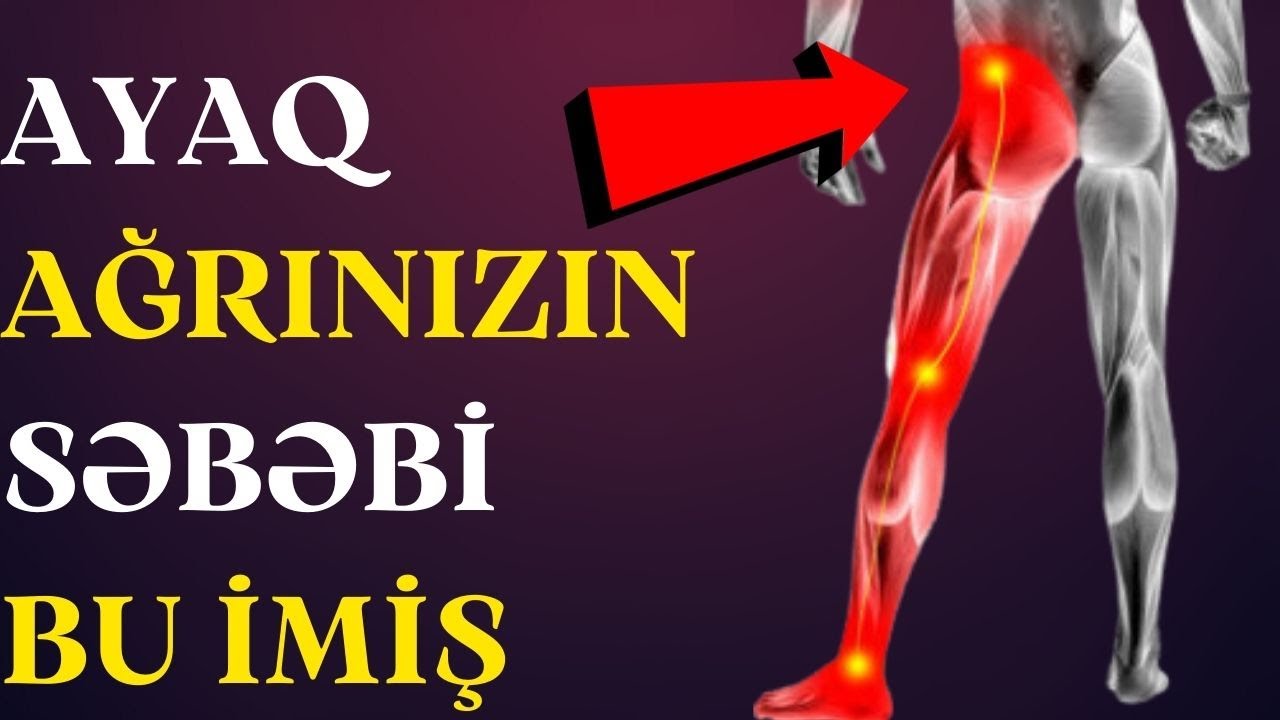 Ayağa Vuran Şiddətli BEL AĞRISININ Səbəbi Bu imiş- Qrijanın Möcüzəvi Müalicəsi!