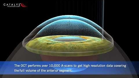 Catalys Full Volume 3D OCT Imaging