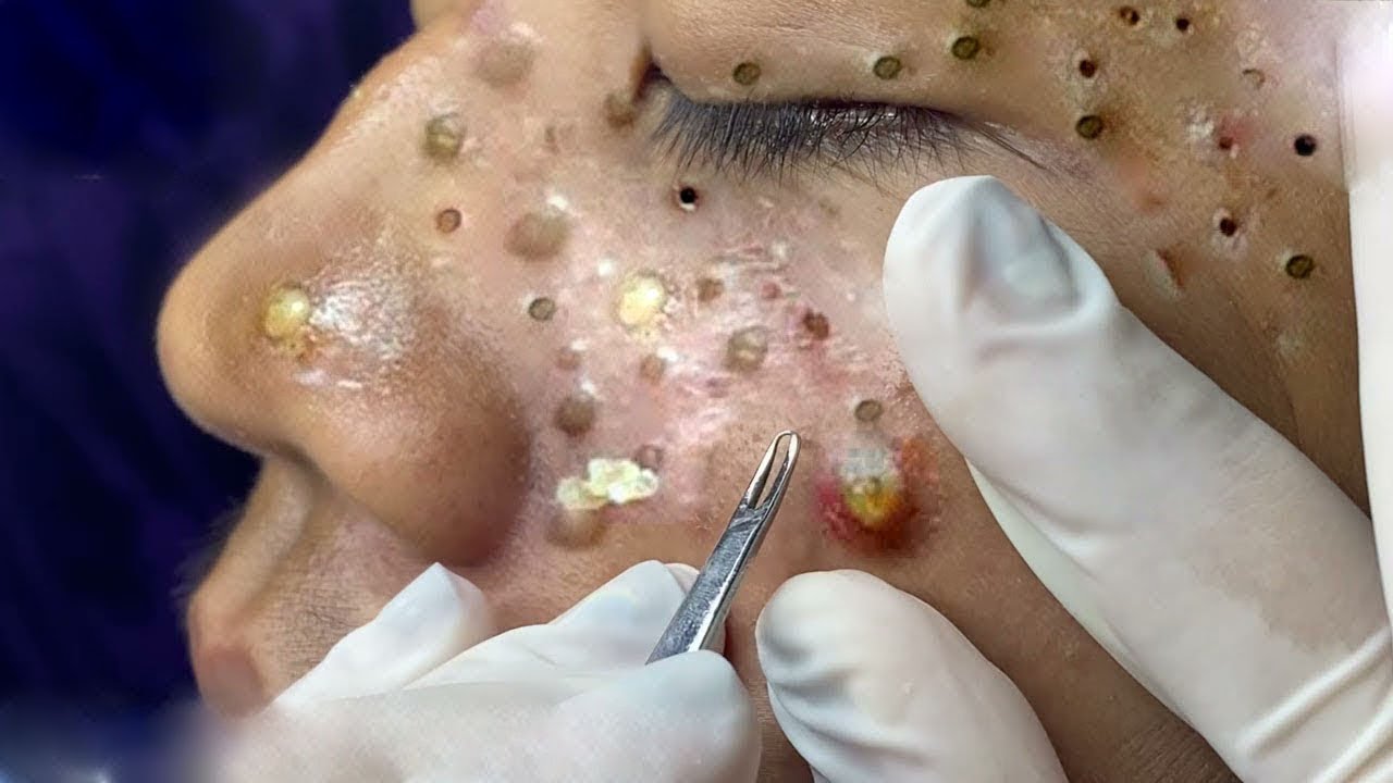 𝑺𝒐𝒐𝒕𝒉𝒊𝒏𝒈 𝑭𝒂𝒄𝒊𝒂𝒍 𝑻𝒓𝒆𝒂𝒕𝒎𝒆𝒏𝒕 𝒇𝒐𝒓 𝑺𝒕𝒓𝒆𝒔𝒔 𝑹𝒆𝒍𝒊𝒆𝒇 | 𝑫𝒆𝒆𝒑 𝑪𝒍𝒆𝒂𝒏𝒊𝒏𝒈 & 𝑪𝒂𝒍𝒎𝒊𝒏𝒈 𝑴𝒂𝒔𝒔𝒂𝒈𝒆 𝒂𝒕 𝑳𝒖𝒙𝒖𝒓𝒚 𝑺𝒑𝒂 