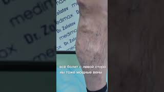 Не запускайте варикоз!!! Это не просто некрасивые вены это может быть опасно для жизни!!!