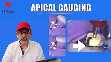 Apical Gauging  ... An IMPORTANT intermediate step between good C&S and Obturation