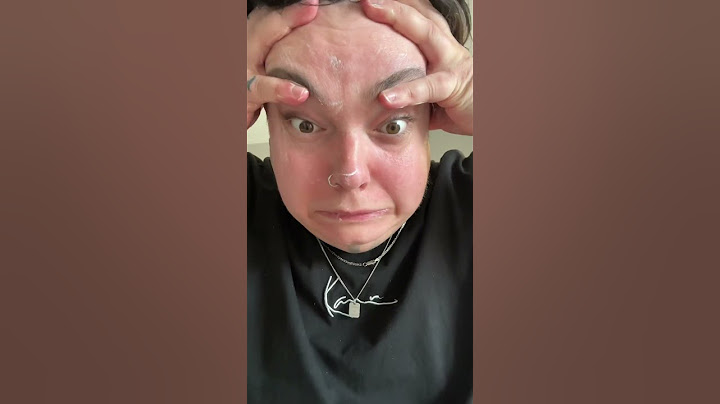 Wenn man damals von seiner Mutti das Gesicht eingecremt bekommen hat 😂