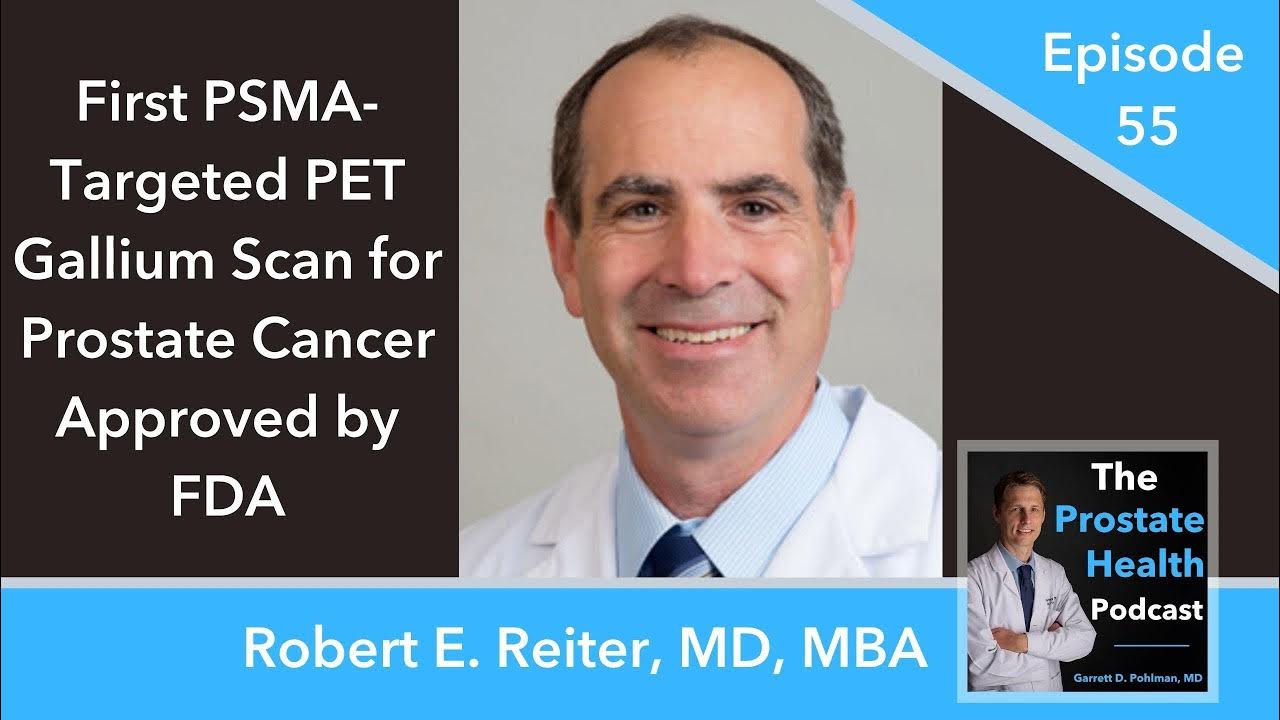 55 First PSMATargeted PET Gallium Scan for Prostate Cancer Approved