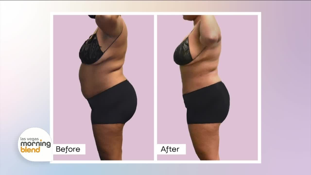different semaglutide medications The Boom in New Weight Loss Drugs: What Prehospital Caregivers Need to Know different semaglutide medications The Boom in New Weight Loss Drugs: What Prehospital Caregivers Need to Know