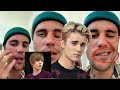 កំពូលតារាចម្រៀង Justin Bieber ឆ្លងមេរោគកម្រ កំពុងប្រឈមនឹងការខ្វិនមុខមួយចំហៀង