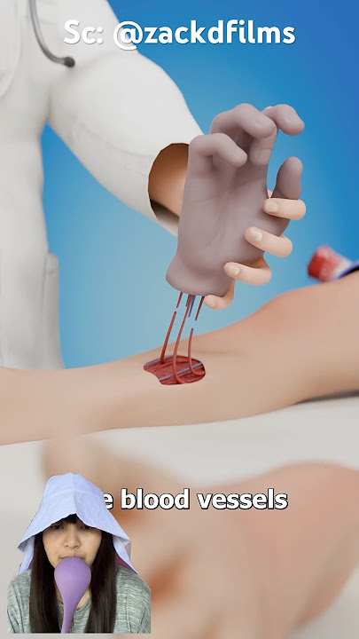 This Man's Hand Was Severed Then Reattached To His Leg #shorts 15 #uniquefacts #momozhiemovie