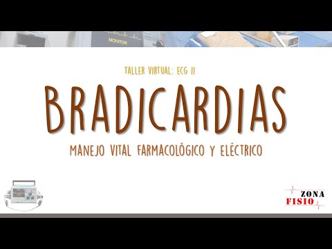 Vídeo: Bradicardia: Síntomas, Causas Y Tratamiento