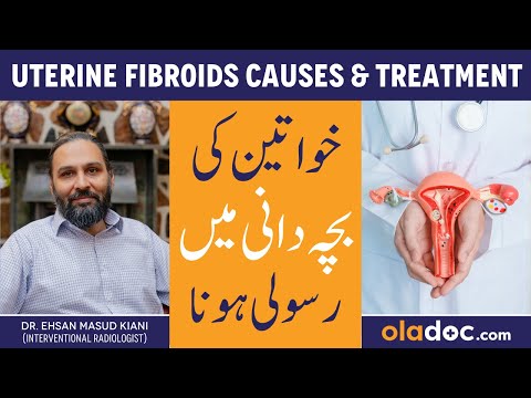 Uterine Fibroids Treatment - Bachedani Me Rasoli Kaise Hoti Hai- Fibroids Ka Ilaj - Fibroid Symptoms