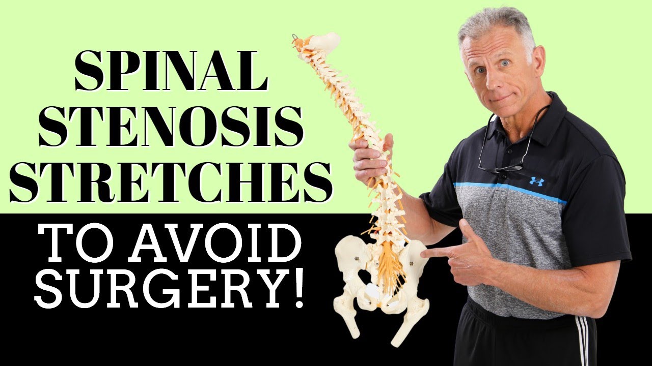 What Are the Final Stages of Spinal Stenosis? - BenchMark Physical Therapy