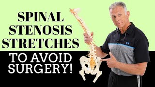 Best 3 Stretches To Quickly Remedy Lumbar Spinal Stenosis \& Avoid Surgery!