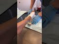 Hahah I Had To Full Update Coming Soon Wana Wanasaga Seaurchin Postsurgery Postop Hawaii Hahah I Had To Full Update Coming Soon Wana Wanasaga Seaurchin Postsurgery Postop Hawaii