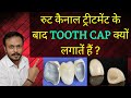 रूट कैनाल के बाद cap क्यों लगातें हैं || Tooth cap after Root canal treatment || Dr.Vaibhav Tiwari