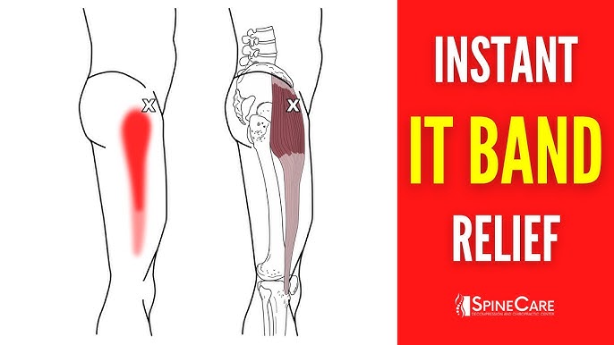 IT Band Pain / Iliotibial Band Friction Syndrome (Myth Busting, Exercises