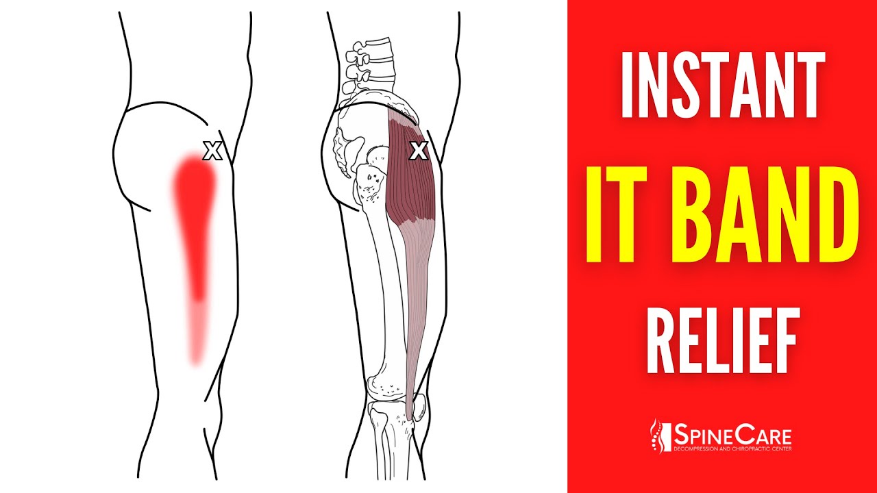 IT Bands and Hip Bursitis