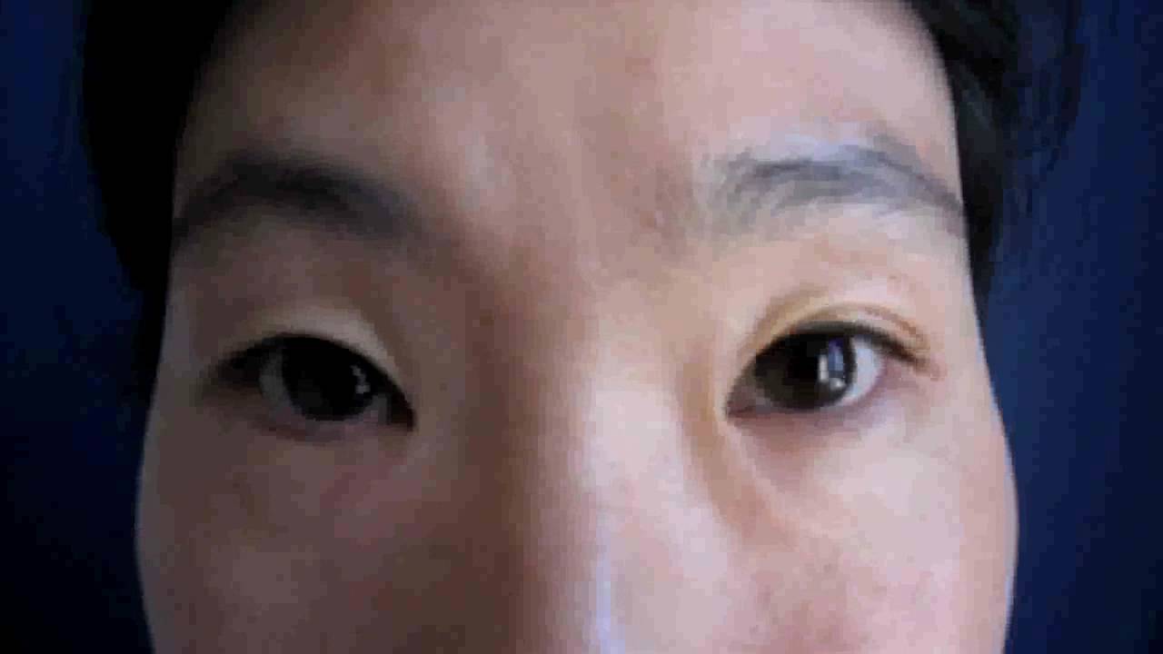 anti gravity clinique