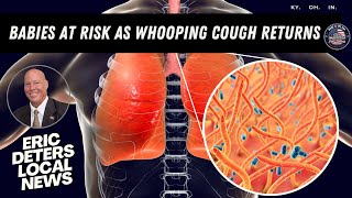 Babies At Risk As Whooping Cough Returns Eric Deters Local News