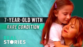 The Girl Whose Muscles Turn to Bone: Luciana's Battle with FOP (Rare Disease Documentary)