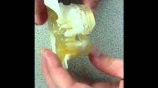 Ibur Biosystems Aligner