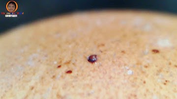 Eggshell Under The Microscope