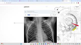 Disease Detection Model | Alzheimer's Disease | Lung Cancer | Pneumonia. Medical Image Analysis.
