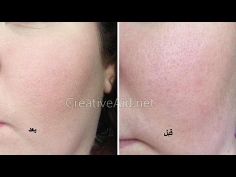 Youtube وصفات للبشرة ذهنية