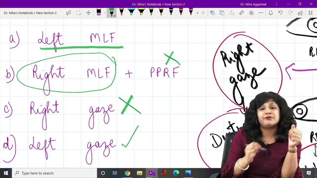 Gaze palsy