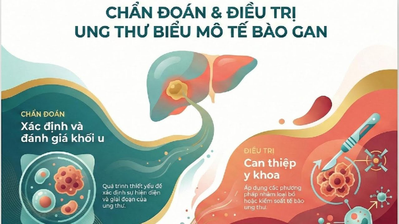 Chẩn Đoán & Điều Trị Ung Thư Biểu Mô Tế Bào Gan