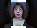 眼袋手術找回自信 消除腫泡大眼袋 Shorts 眼袋手術找回自信 消除腫泡大眼袋 Shorts