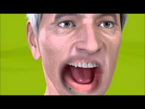 Straumann  Removable