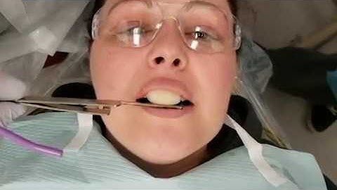 Leaf Guage, Anterior Deprogrammer, and Lucia Jig - 3 more methods to capture CR - Dr. Mark R. Taylor