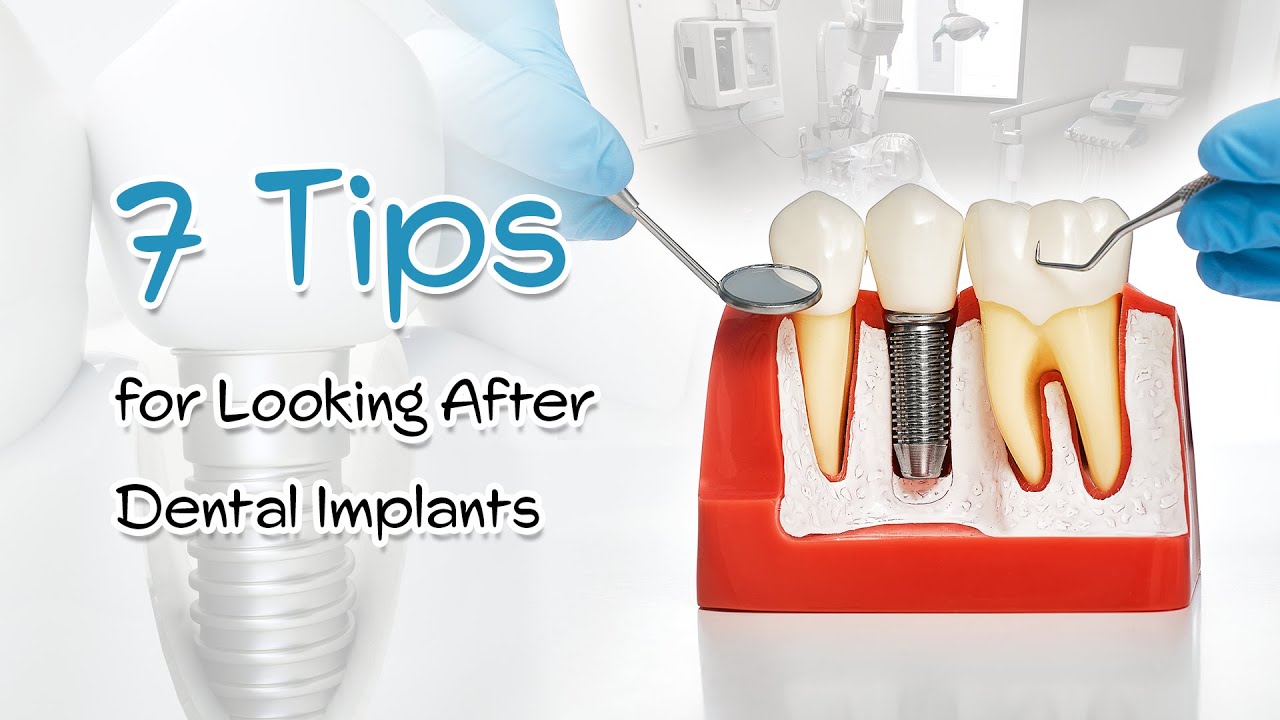 Dental Implant Care 7 Tips for Looking After Your Implants YouTube