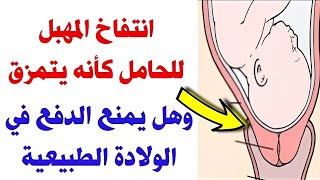 انتفاخ المهبل للحامل كأنه يتمزق ؟ وهل يمنع الولادة الطبيعية ؟