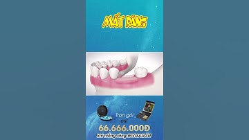 [3D] MẤT RĂNG || Nha Khoa Quốc Tế Athena