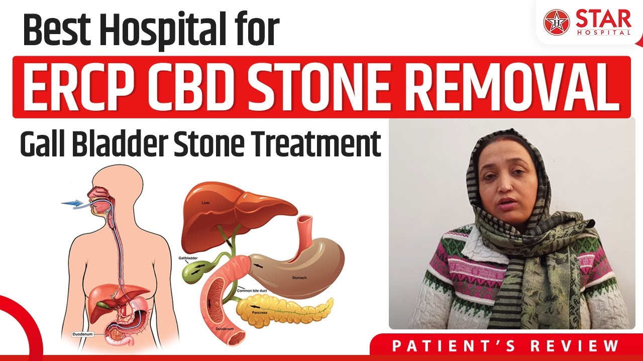 Best Hospital for CBD Stone in Jalandhar | Best CBD Specialist in ...