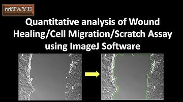 Quantitative analysis of Wound Healing, Cell Migration or Scratch Assay using ImageJ Software