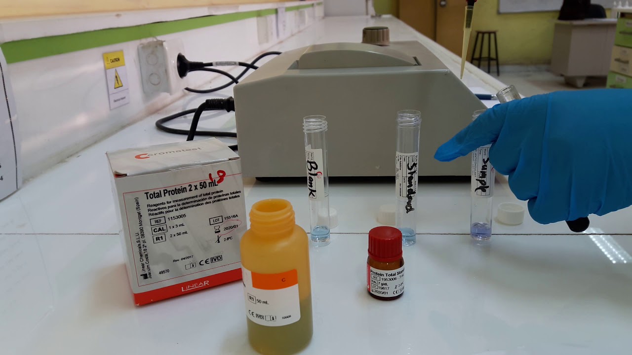 Determination of Total Protein in Blood