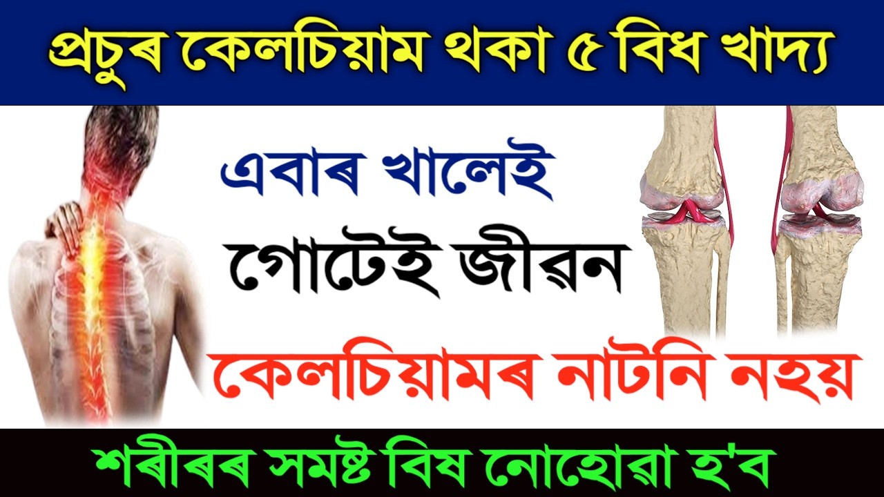 প্ৰচুৰ কেলচিয়াম থকা ৫ বিধ খাদ্য এবাৰ খালেই গোটেই জীৱন কেলচিয়ামৰ নাটনি নহয় | শৰীৰৰ সমষ্ট নোহোৱা হব